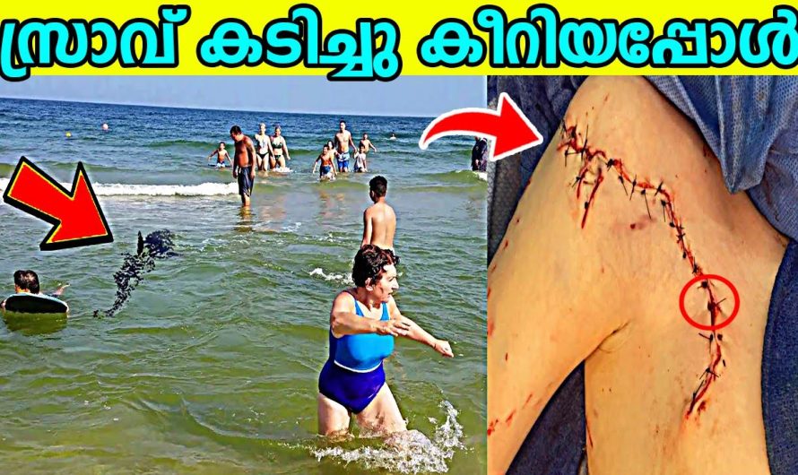 സ്രാവിന്റെ വായിൽ അകപ്പെട്ട ഇയാൾക്ക് സംഭവിച്ചത് കണ്ടോ