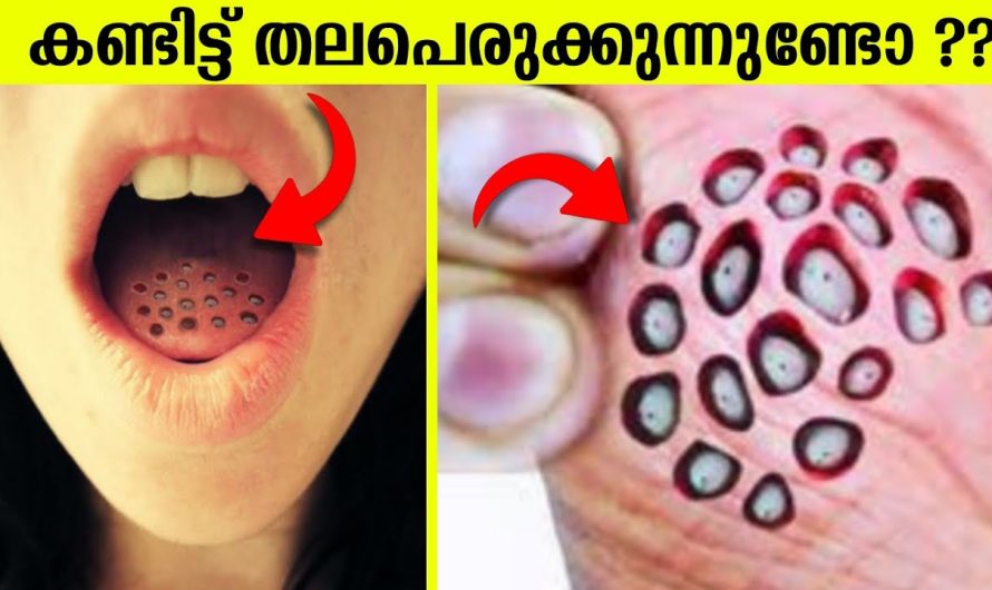 വിചിത്രമായ 10 അസുഖങ്ങൾ !