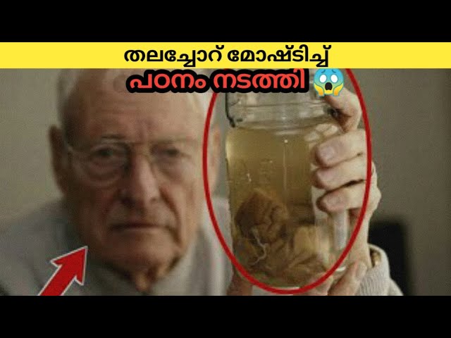 ഐൻസ്റ്റീന്റെ മോഷ്ടിക്കപ്പെട്ട തലച്ചോർ 😱