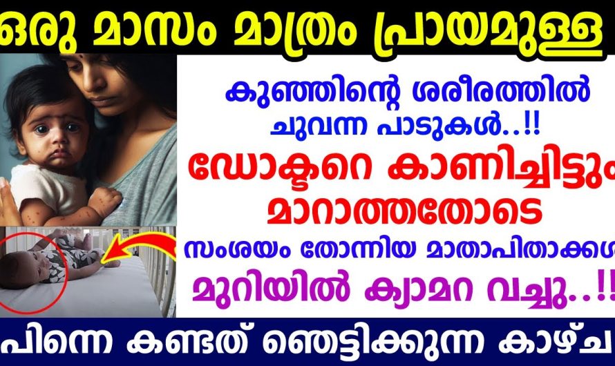 ചുവന്ന പാടുകൾ ചികിത്സ നൽകിയിട്ടും വീണ്ടും വീണ്ടും വരുന്നു, ഒടുവിൽ CCTVയിൽ കണ്ട ഞെട്ടിക്കുന്ന കാഴ്ച