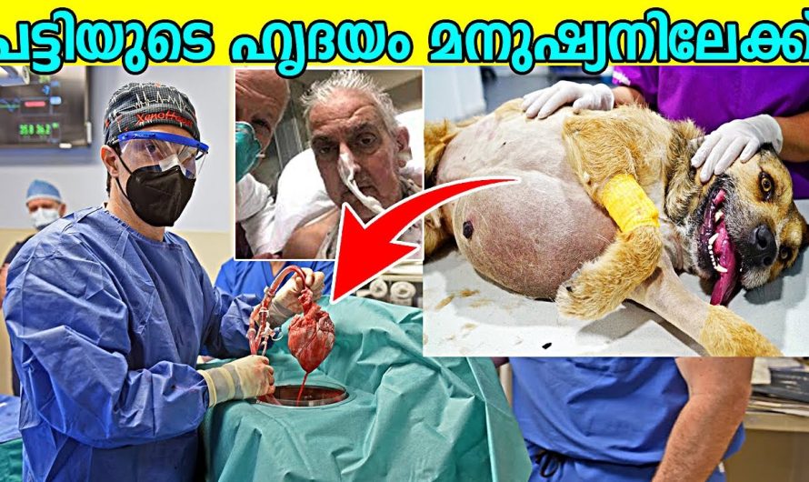 ശരീരത്തിൽ ഹൃദയമില്ലാതെ വർഷങ്ങളോളം ജീവിച്ച വ്യക്തികൾ…