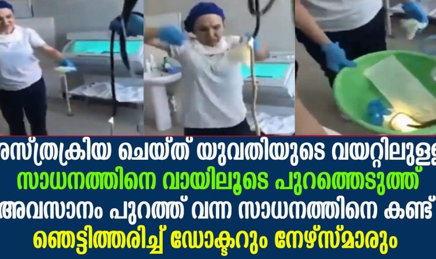 ശസ്ത്രക്രിയ ചെയ്ത് യുവതിയുടെ വയറ്റിലുള്ള സാധനത്തിനെ കണ്ട് ഞെട്ടിത്തരിച്ച് ഡോക്ടറും നേഴ്സ്മാരും