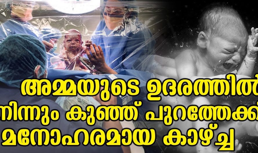 അമ്മയുടെ ഉദരത്തിൽ നിന്നും കുഞ്ഞ് പുറത്തേക്ക് മനോഹരമായ കാഴ്ച്ച
