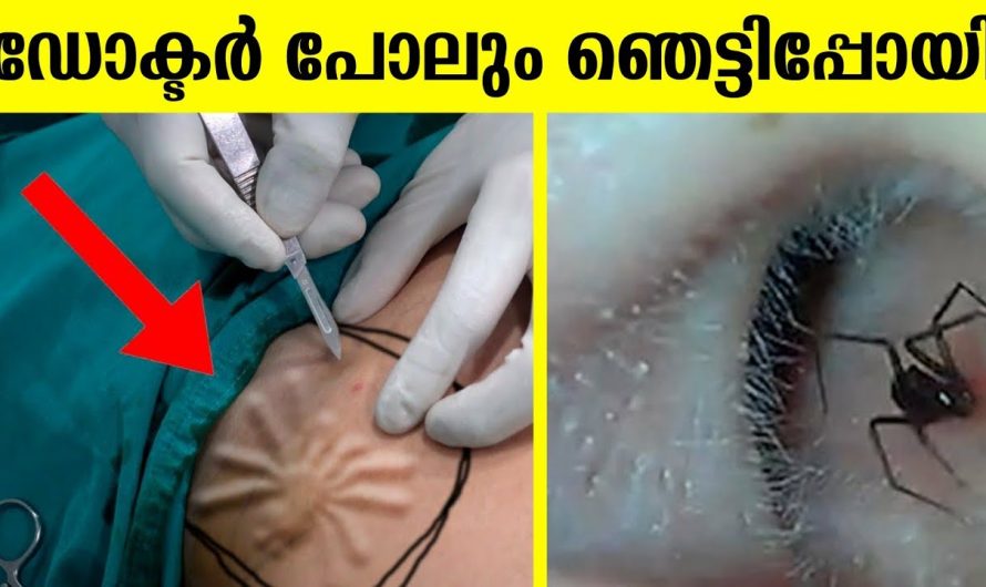 കാഴ്ചകണ്ട് DOCTOR പോലും ഞെട്ടിപ്പോയി