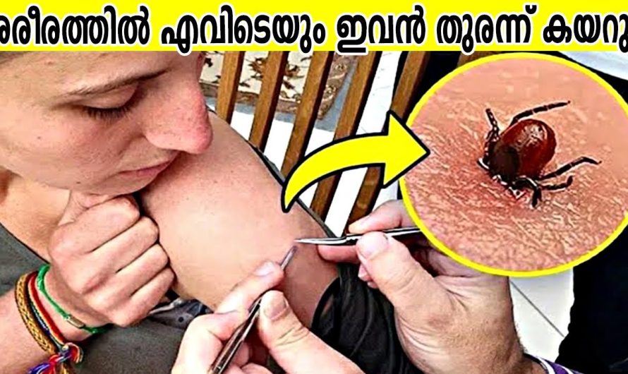 ഇതിനെ കണ്ടാൽ ഓടി രക്ഷപെട്ടോ
