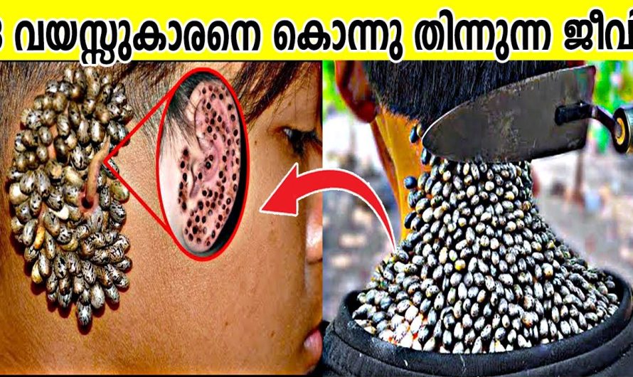 8 വയസ്സുകാരനെ കൊന്നു തിന്നുന്ന ജീവി