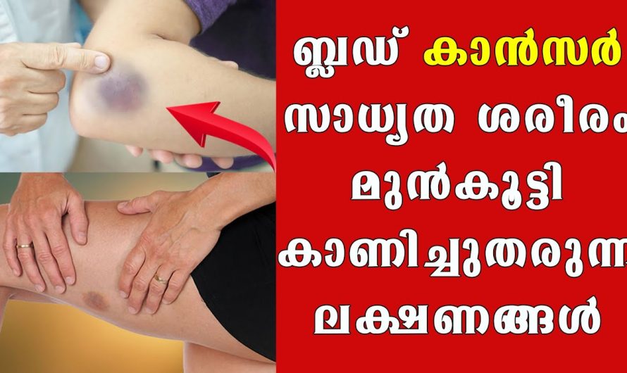 ബ്ല.ഡ്‌ കാ..ന്‍..സ.ര്‍ ശരീരം വളരെ മുന്‍കൂട്ടി കാണിച്ചുതരുന്ന ലക്ഷണങ്ങള്‍