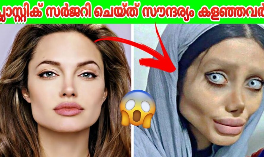 പ്ലാസ്റ്റിക് സർജറി ചെയ്‌ത് സൗന്ദര്യം കളഞ്ഞവർ!