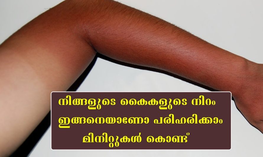 നിങ്ങളുടെ കൈകള്‍ ഇങ്ങനെയാണോ വിഷമിക്കേണ്ട വെളുപ്പിക്കാം