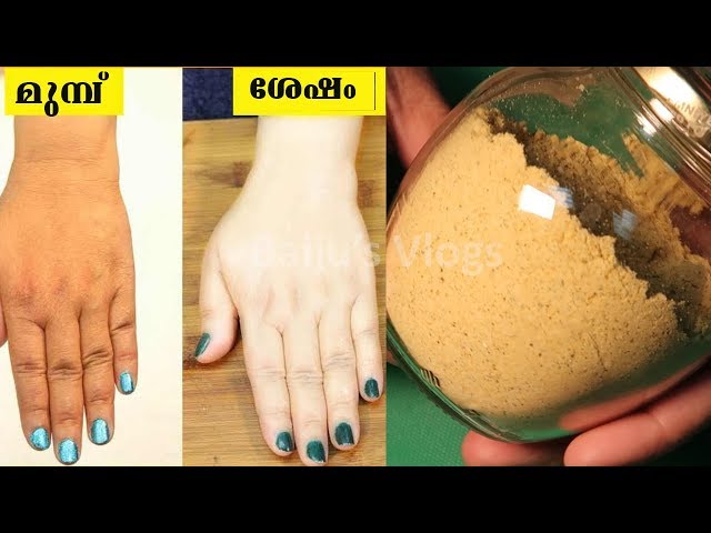 വെളുക്കില്ലന്നു കരുതിയ നിങ്ങളുടെ സ്കിന്നിനു
