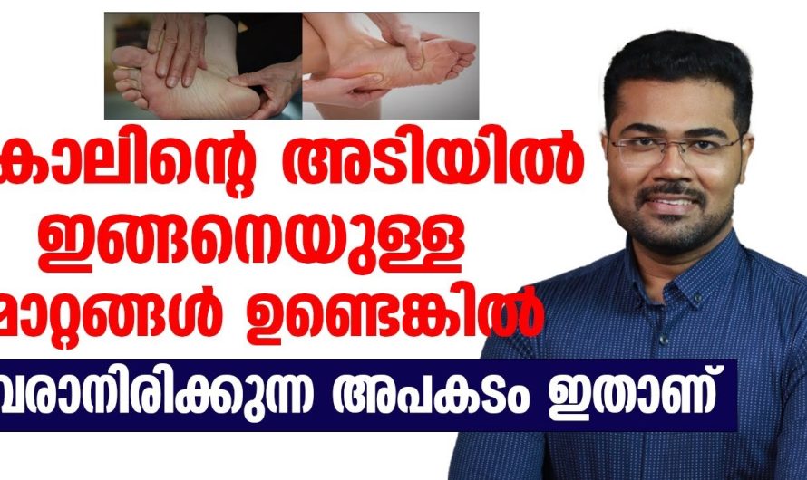 കാലിന്റെ അടിയിൽ ഇങ്ങനെയുള്ള മാറ്റങ്ങൾ വരാനിരിക്കുന്നത് വൻ അ.പ.കടം