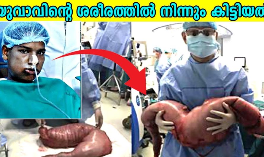 യുവാവിന്റെ ശരീരത്തിൽ നിന്നും കണ്ടെത്തിയത്